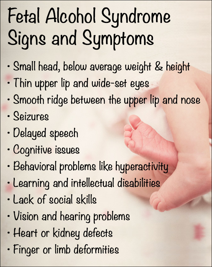 Fetal Alcohol Syndrome Heart Defects